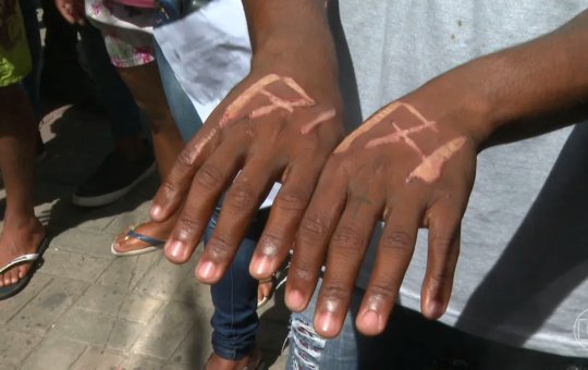 Empresários acusados de queimar mãos de funcionários são indiciados em Salvador