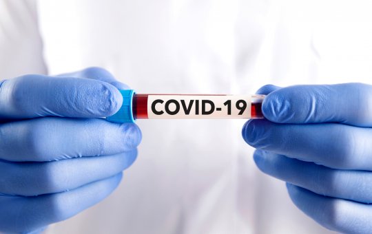 Covid-19: Brasil tem 4.996 novos casos e 51 mortes em 24 horas