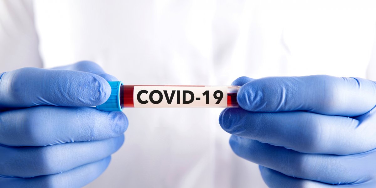 Covid-19: Brasil tem 4.996 novos casos e 51 mortes em 24 horas