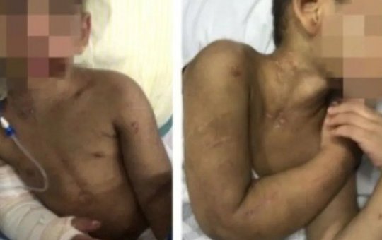 Criança é espancada por "bagunçar" casa que mora em São Vicente-SP