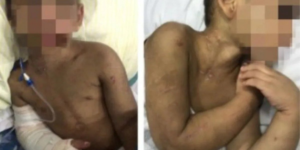 Criança é espancada por "bagunçar" casa que mora em São Vicente-SP