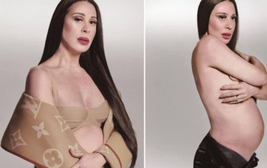 Grávida, Claudia Raia faz ensaio de topless e causa nas redes sociais