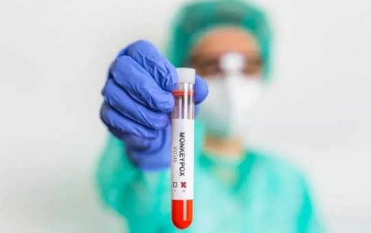 Sesab confirma 116 casos de varíola dos macacos na Bahia