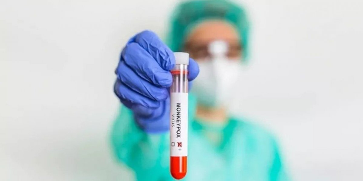 Sesab confirma 116 casos de varíola dos macacos na Bahia