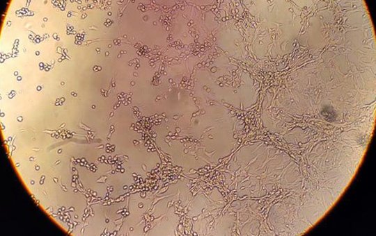 Em São Paulo, homem morre devido a varíola dos macacos