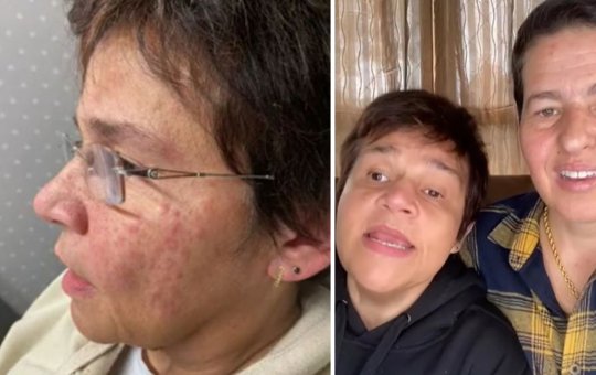 Claudia Rodrigues tem alta após inflamação generalizada: "Estou limpa"