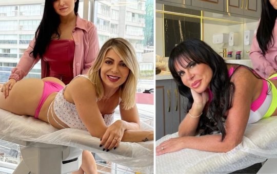 Gretchen e Sheila Mello fazem procedimento no bumbum; confira os resultados