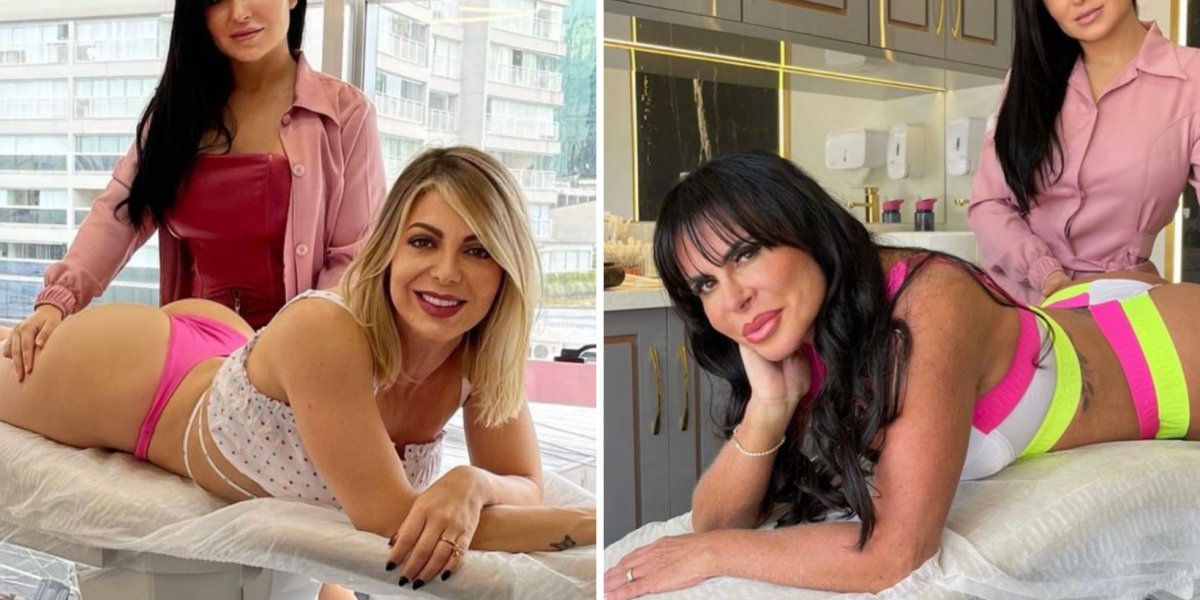 Gretchen e Sheila Mello fazem procedimento no bumbum; confira os resultados