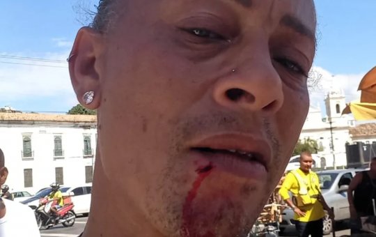Ator de 'O Paí Ó', Lyu Árisson relata agressão em São Joaquim, em Salvador