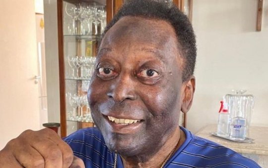 Pelé teve Covid-19 e ronco pulmonar antes de ser internado, diz site
