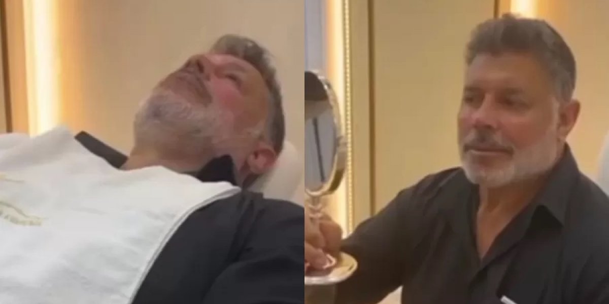 Alexandre Frota passa por harmonização facial e publica resultado na web; veja