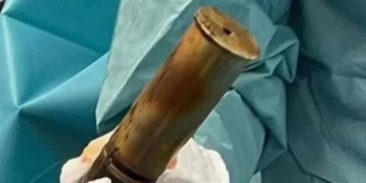 Idoso chega a hospital com bomba alojada no ânus e faz local ser evacuado