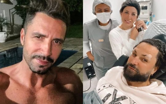 Latino aparece irreconhecível após realizar procedimentos estéticos