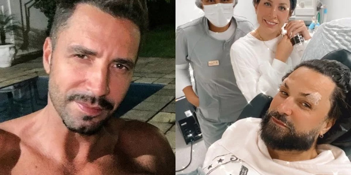 Latino aparece irreconhecível após realizar procedimentos estéticos