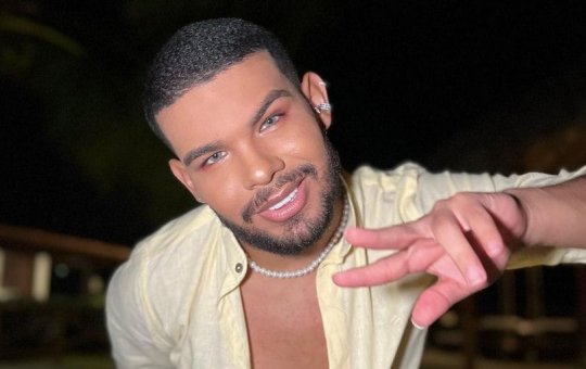 Ex-BBB Vyni adere à harmonização facial, barba preenchida e olhos azuis