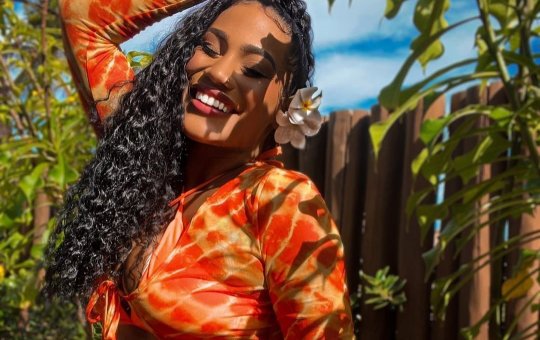 Kelly Pereira passa por procedimentos estéticos e exibe resultado nas redes