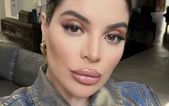 Gkay retira procedimento estético e mostra antes e depois nas redes; confira