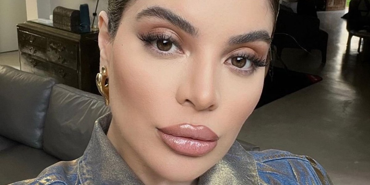 Gkay retira procedimento estético e mostra antes e depois nas redes; confira