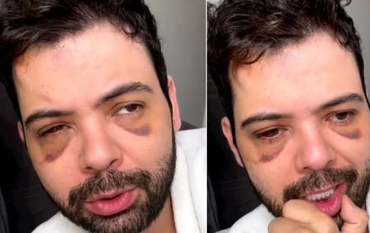 Gustavo Mendes revela que se equivocou sobre denúncia de assalto em Minas Gerais