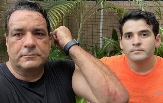 Deputado Alan Sanches relata agressão durante assalto na Barra: “Seis marginais”