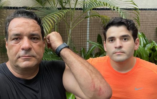 Deputado Alan Sanches relata que foi assaltado e agredido na Barra