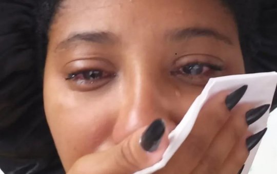 Jovem relata hemorragia ocular após uso de pomada modeladora em Salvador