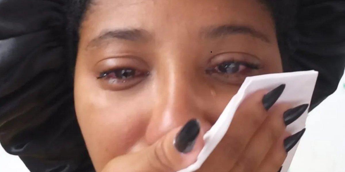 Jovem relata hemorragia ocular após uso de pomada modeladora em Salvador