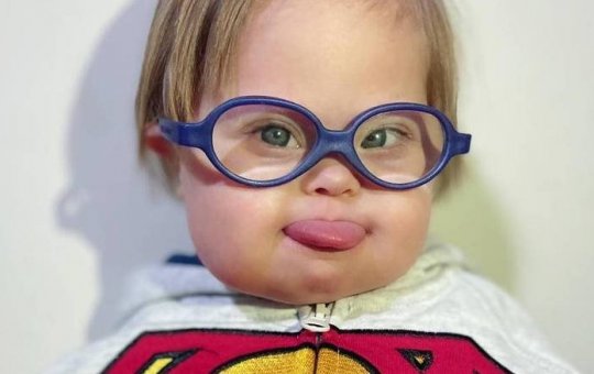 Morre Super Chico, menino com Down que superou a Covid por duas vezes