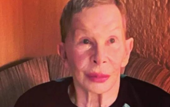 Marido de Rita Lee surpreende e posta foto da cantora curada do câncer