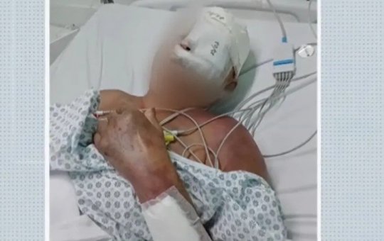 Camaçari: Idosa de 68 anos é espancada com barra de ferro; ex-marido é suspeito