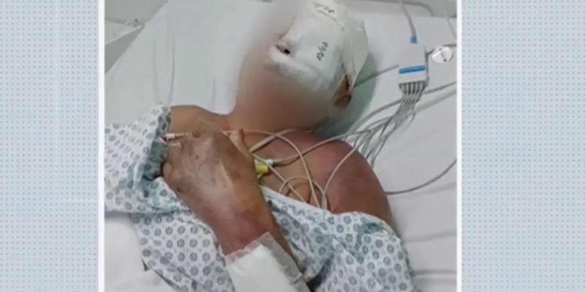 Camaçari: Idosa de 68 anos é espancada com barra de ferro; ex-marido é suspeito