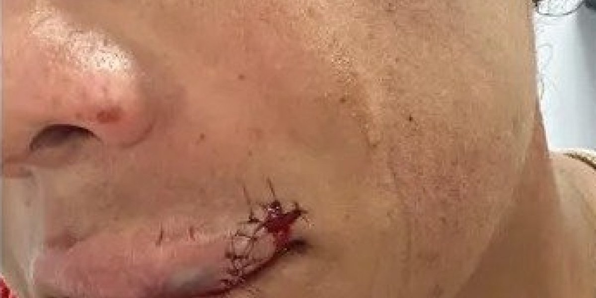 Mulher diz ter sido agredida com murro na boca em bloco puxado por Bell Marques