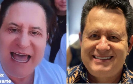 Marrone faz harmonização facial e divide opiniões