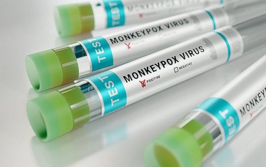 Bahia recebe mais 400 mil doses de vacinas contra varíola dos macaco