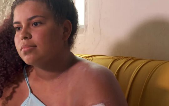 Adolescente de 15 anos se recupera em casa ao sobreviver a um ataque de tubarão