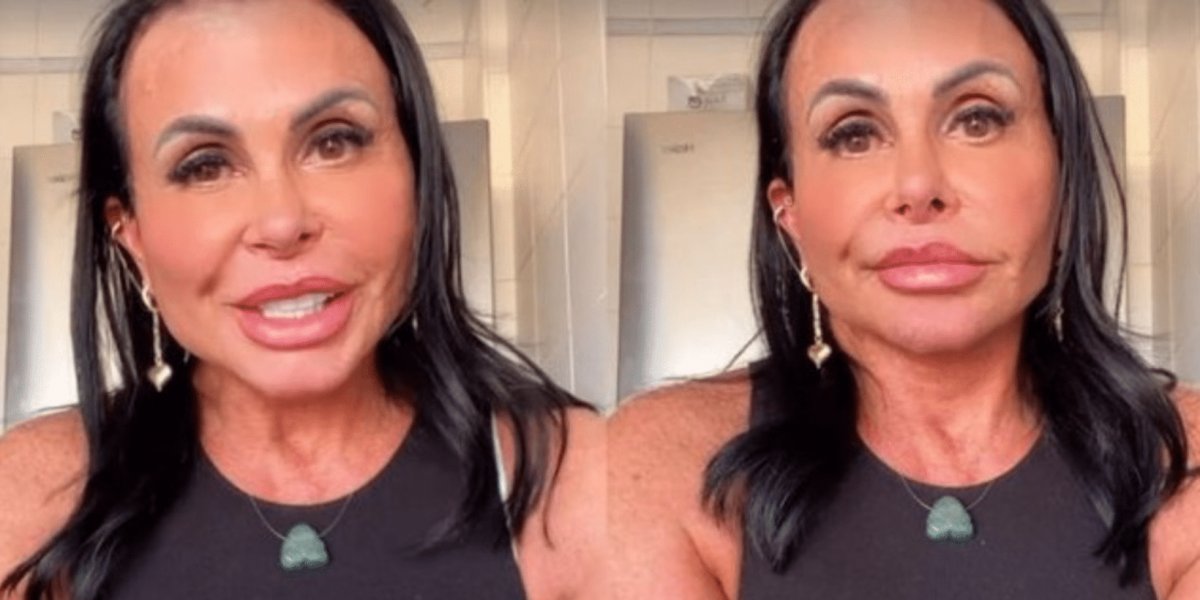 "História fake", diz Gretchen após ser criticada por suposta harmonização facial