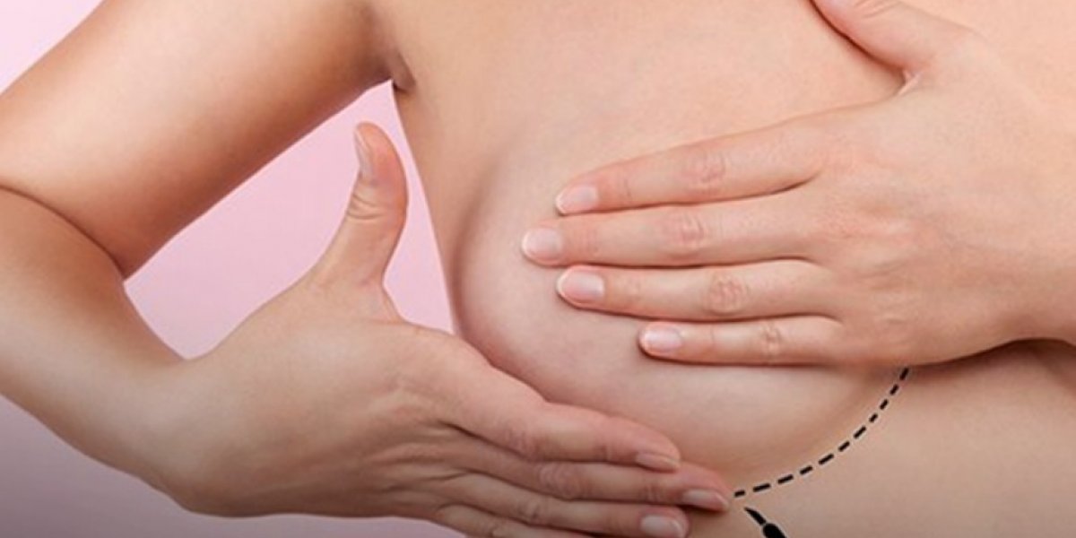 Exames de mamografia são oferecidos gratuitamente no Barradão