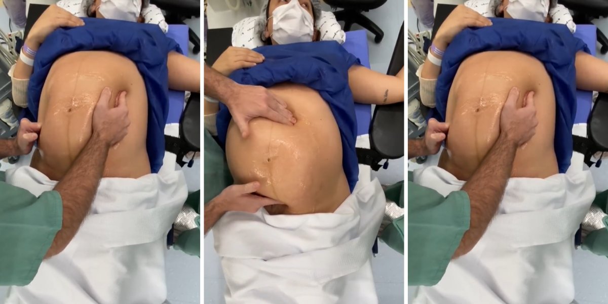 Viralizou! Médico vira bebê dentro do útero momentos antes do parto; Veja