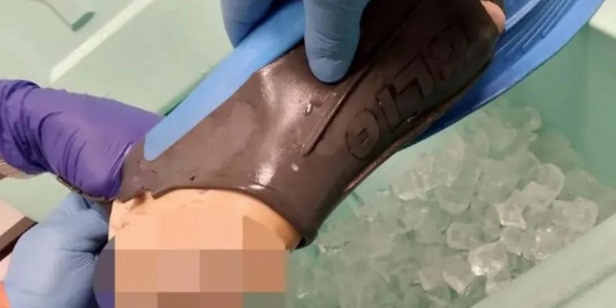 Tubarão arranca pé de turista em praia nos EUA; imagens impressionam