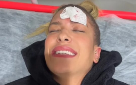 Lore Improta bate quina da porta do carro em sua testa e precisa tomar pontos