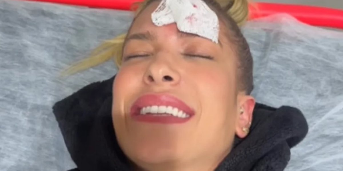 Lore Improta bate quina da porta do carro em sua testa e precisa tomar pontos