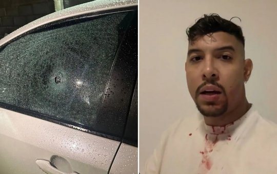 "Tentaram me matar", diz influencer Fábio Silveira ao relatar ataque a tiros