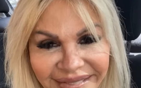 "Estou tão feliz": Monique Evans mostra rosto sem filtro após harmonização