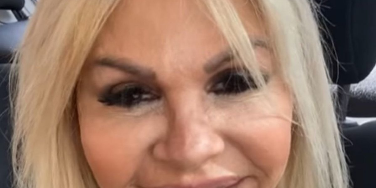 "Estou tão feliz": Monique Evans mostra rosto sem filtro após harmonização