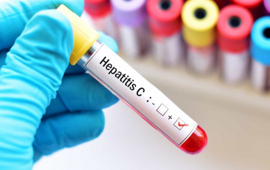 Fiocruz assina acordo para produzir medicamento para hepatite C