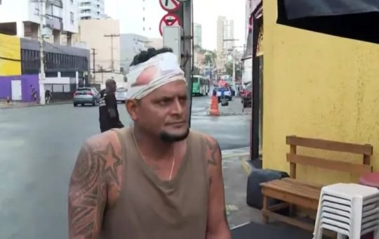 Após ser atropelado na Barra, vendedor de espetinho fica com lesões na cabeça