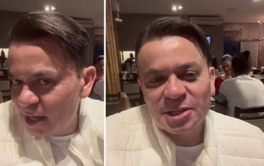 "Parecendo com Brad Pitt", diz Frank Aguiar após harmonização facial