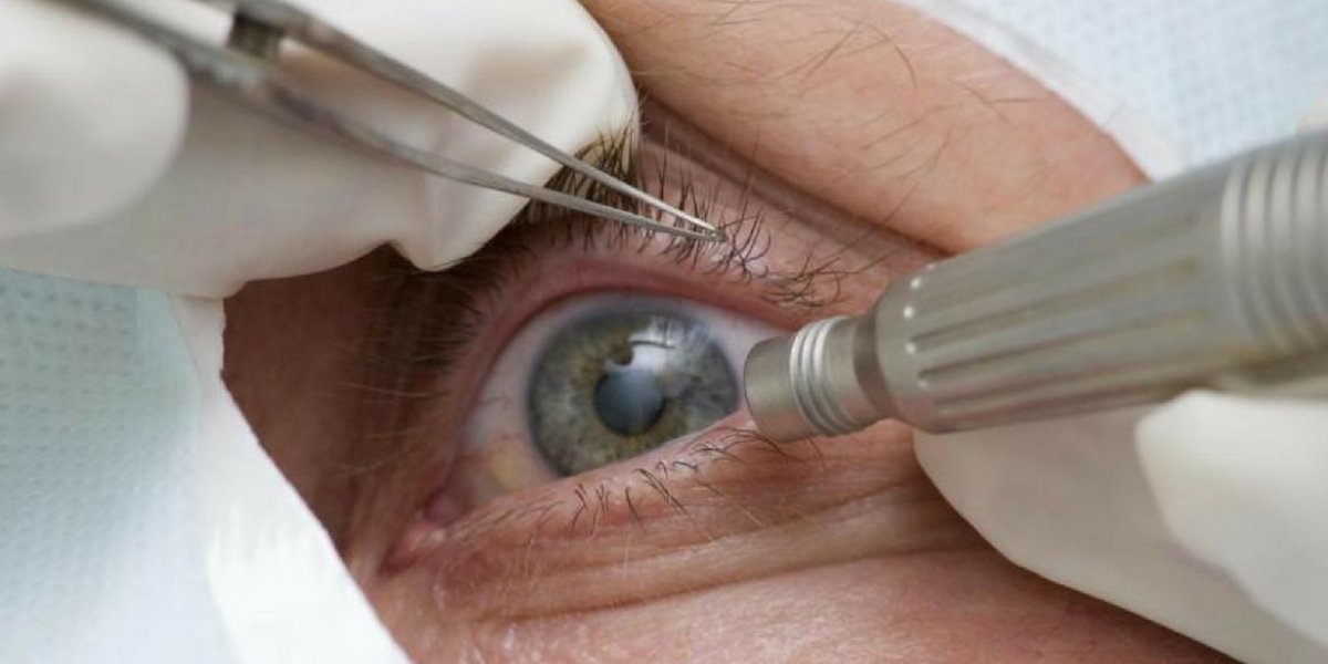 Oftalmologistas alertam para risco de suplementos com promessa de cura