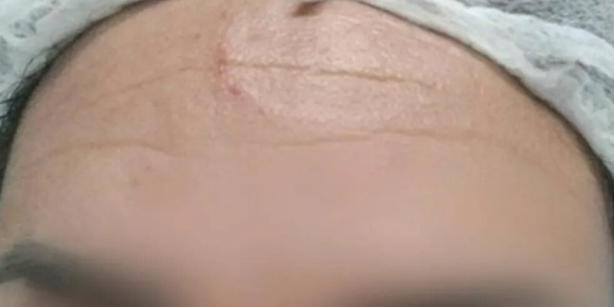 Casal agride técnica de enfermagem em centro de saúde da capital