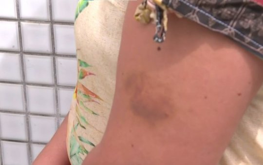 Mulher relata agressão de ex-companheiro em  aniversário da filha em Salvador